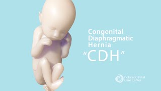 CDH Part 1: What is Congenital Diaphragmatic Hernia?