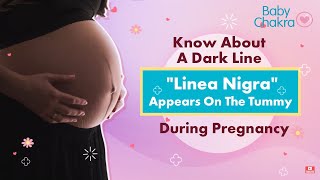 What Does A Dark Line Called Linea Nigra Means | Linea Nigra During Pregnancy | BabyChakra Videos