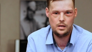 Face Transplant Links Men Touched by Tragedy