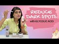 Dark spots on face | Glycolic Acid| How to use Glycolic acid serum| Loreal Paris Glycolic Bright