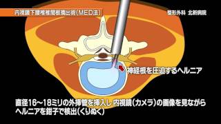 【ヘルニア】特定医療法人朋仁会　整形外科　北新病院