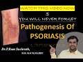 Pathogenesis of PSORIASIS made easy for dermatology residents I Dr.Ram Sushruth