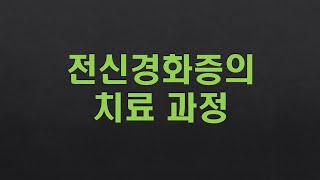 호전과 악화가 반복되는 전신경화증의 치료 과정