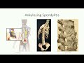 ana407 class 2.3 introduction to the vertebral column