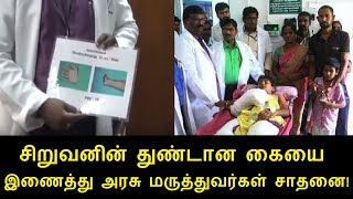 மீண்டும் இணைந்த சிறுவனின் கை! சேலம் அரசு தலைமை மருத்துவமனை மருத்துவர்கள் சாதனை