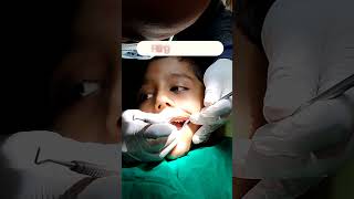 GIC restoration/ Drmaheshwar /preciousdentalclinic/ child/ Dentist in Katandu