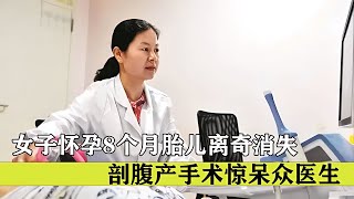 女子懷孕8個月做產檢，竟發現胎兒不見了，剖腹產手術驚呆眾醫生 #纪录片 #x調查 #紀錄片 #抗日 #纪录片解说