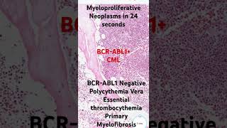 Myeloproliferative Neoplasms in 24 seconds #pathagonia #hemepath #step1 #step2 #step3 #medical