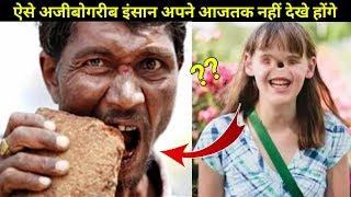 दुनिया के 5 विचित्र (अजीबोगरीब) लोग देखकर चौक जाएंगे आप  5 Strange People You Wont Believe