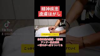 精神疾患(自律神経失調症・花粉症・アトピー性皮膚炎)は皮膚が硬い→背中の皮膚はがし【アナトミートレイン】