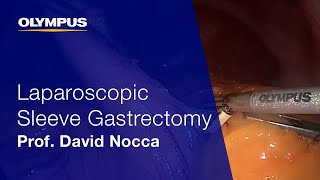 Laparoscopic Sleeve Gastrectomy | THUNDERBEAT | Prof. David Nocca