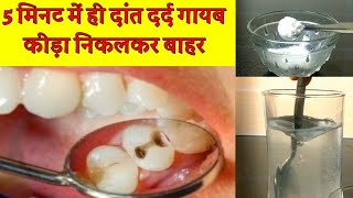 5 मिनट में दांत दर्द गायब घरेलू इलाज, Home Remedy for toothache,Dant dard ka elaj,tooth pain relief