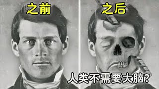 没有大脑能存活吗？这个视频告诉你发生在人类身上“最可怕”的事