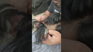 Natural Frontline in Delhi | Hair Patch #reels #explorepage #viral #explore #hairpatch #amazing
