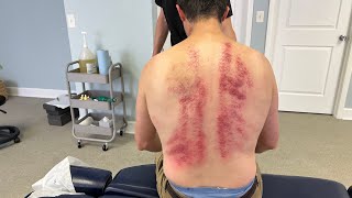 Man Searches His Soul & Seeks Answers FOR Painful Back Spasms 😥 Deep Cracks & IN