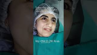 #rinoplastika burun əməliyyatı Rinoplastika möhtəşəm nəticə sizlərlə #keşfet #azerbaijan #burun #usa