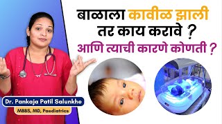 बाळाला कावीळ होण्याची कारणे कोणती ?। बाळाला कावीळ झाल्यास काय करावे ? |Causes of Jaundice in Babies