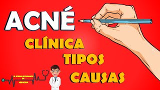 ACNÉ Dermatología | Tipos de acné y causas 📝👨🏻‍⚕️LO QUE DEBES CONOCER - Acné Fulminans y Conglobata