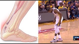 Kevin Durant Injured l Achilles or Calf? - Rockets vs Warriors