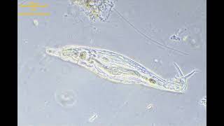 4K　活性汚泥の微生物　瀕死のロタリア(Rotaria)