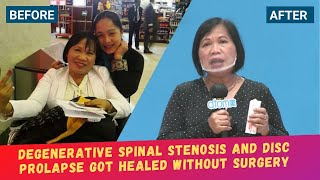 Hemohim Testimony: Christine Medrano's Sciatica Spinal Stenosis Got Healed without Surgery