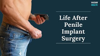 Life After Penile Implant Surgery