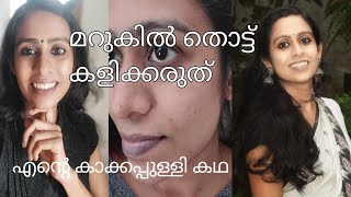 എന്റെ മറുക്  കഥ/ മറുക് കളയാൻ ഞാൻ ചെയ്തത്/ മറുക് എങ്ങനെ ഉണ്ടാകുന്നു/ പരിഹാര മാർഗ്ഗങ്ങൾ/ Black mole /-