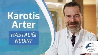 Karotis Arter Hastalığı Nedir❓#karotisartterhastalığı