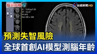 預測失智風險 全球首創AI模型測腦年齡【發現科學】