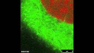 Microtubule Dynamics: EB1 and H2B in live HeLa cells