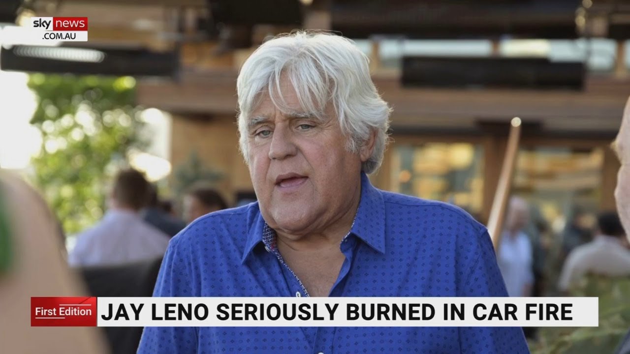 Jay Leno Seriously Burnt After Car Fire - YouTube