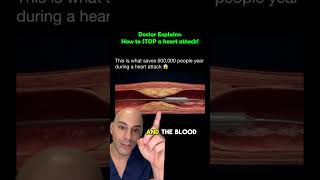 How Doctors Stop A Heart Attack Before Its Too Late