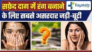 कैसे 1 जड़ी बूटी बदल सकती है आपका जीवन? | 1 Herb for Vitiligo (Safed Daag) | Kayakalp Global