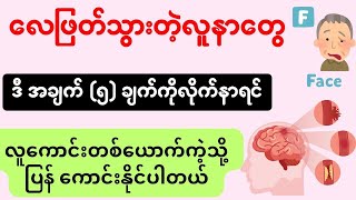 လေဖြတ်တာကို မြန်မြန်သက်သာချင်ရင် ဒီအချက် ( ၅ ) ချက်ကို သိထားဖို့ လိုပါတယ် - stroke