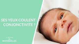 Ses yeux coulent : conjonctivite ?  - La Maison des maternelles #LMDM