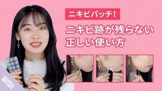 【ニキビケア】 ニキビパッチの正しい使い方！種類ごとに使い方があるって知ってた？