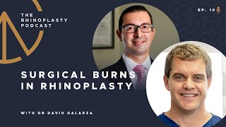 #016 The Rhinoplasty Podcast | Dr David Galarza