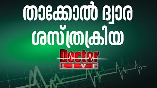 Keyhole Surgery | താക്കോല്‍ ദ്വാര ശസ്ത്രക്രിയ  | Doctor Live 3 Sep 2016