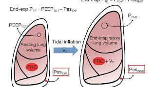 QUAIS CONDIÇÕES CLÍNICAS A PEEP PODE SER USADA COM VALORES DIFERENTES DE 5 CMH20?