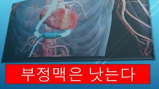 부정맥은 낫는다, 부정맥 치료 양방으로 할까? 한방으로 할까?