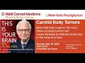 This Is Your Brain: Carotid Body Tumors, with Dr. Philip E. Stieg