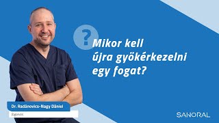 Mikor és miért kell újra gyökérkezelni egy fogat?