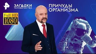 Причуды организма — Загадки человечества с Олегом Шишкиным 07 03 2024