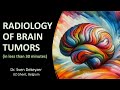 RADIOLOGY OF BRAIN TUMORS - the absolute basics