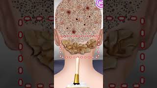 پاکسازی و کوتاهی مو به روش ای اس ام آر persian ASMR #بازی #نجمه #پاکسازی