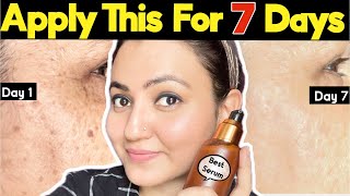इस VITAMIN C SERUM से पुराने झाइयां Blemishes Spots बेजान Skin ka होगा 100% इलाज #clearskin