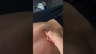 HUGE KNOT OUCH! #Lowerback #adhesion #pain #knots