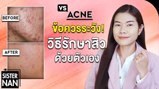 4 ข้อควรระวัง! หากรักษาสิวด้วยตัวเอง สิวหายเร็ว ต้องรักษาสิวยังไง? หน้าใส ไร้สิว | แนน Sister Nan