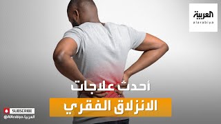 صباح العربية | ما أحدث علاجات الانزلاق الفقري؟