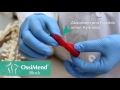 collagen matrix orthopaedic ossimend® block product demo